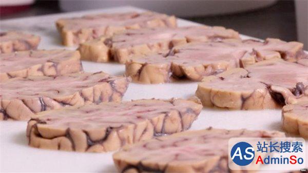 揭秘英国大脑银行：解剖捐献者大脑，医学贡献巨大