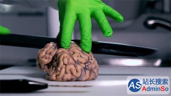 揭秘英国大脑银行：解剖捐献者大脑，医学贡献巨大